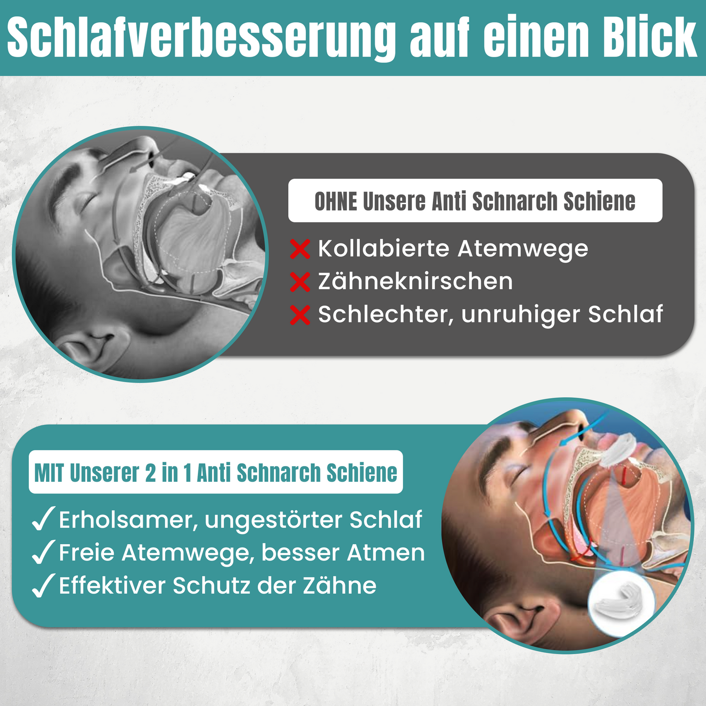 Anti Schnarch Schiene gegen Schnarchen – Schnarchstopper Knirscherschiene für Nacht | Sofort Einsatzbereit Zahnschiene
