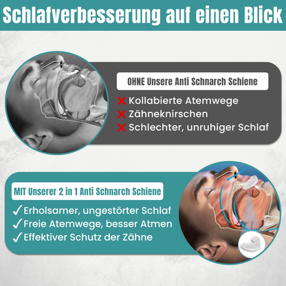 Anti Schnarch Schiene gegen Schnarchen – Schnarchstopper Knirscherschiene für Nacht | Sofort Einsatzbereit Zahnschiene